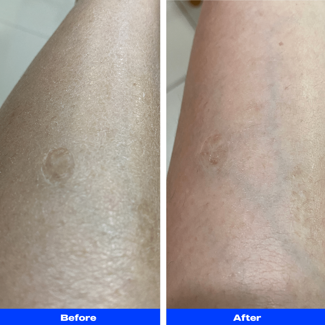Body Exfoliator