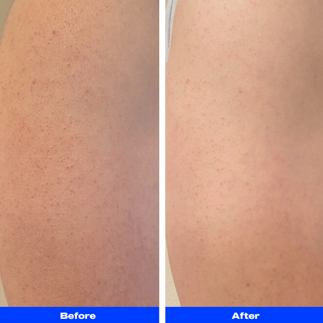 Body Exfoliator